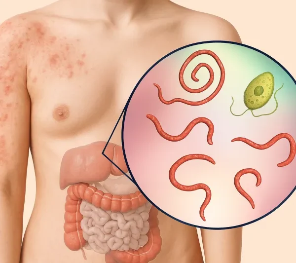 How to Eliminate Intestinal Parasites: A Clinical Guide